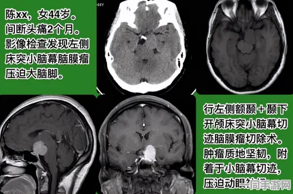 和脑有关的疾病，脑部健康危机下的生命突围战—解码神经退行性疾病防治盲区